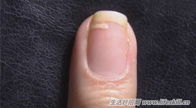 指甲裂开了不用烦,教你一招巧修复!