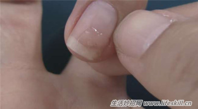 指甲裂开了不用烦,教你一招巧修复!